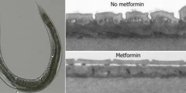 Diabetes Drug Metformin Slows Aging, Says PNAS Study
