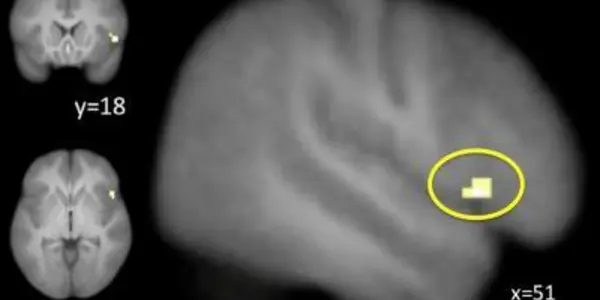 Do Those Brain Training Games And Websites Work? Sort Of