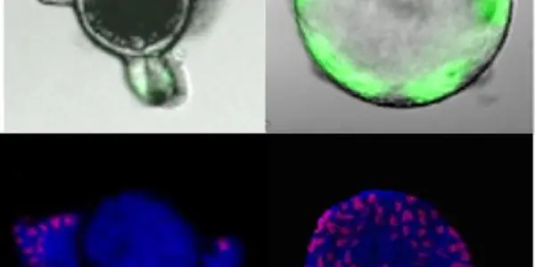How Gut Inflammation Sparks Colon Cancer