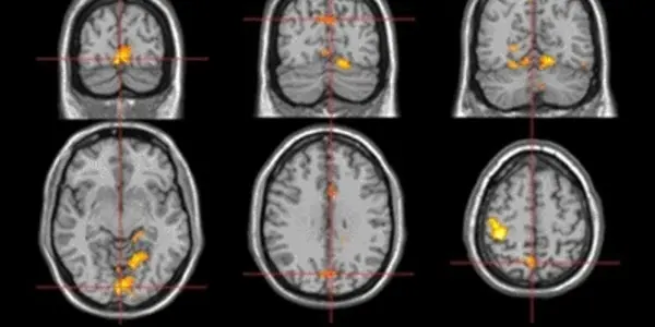 It's Not Cognitive Decline, Older Brains May Be Slower Because They Know More