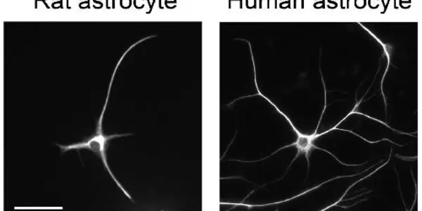 First Look At How Astrocytes Function In Humans