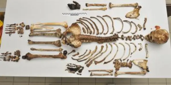 Investigative Genetics: Forensic Science Can Discover Hair, Eye Color From Medieval Remains