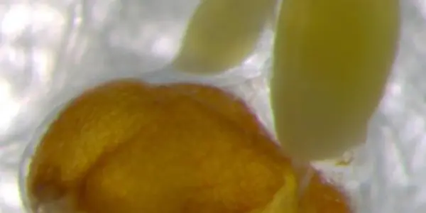 Researchers Find Key To Zinc Rich Plants To Combat Malnutrition