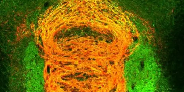 Study Reveals New Mechanism In Nicotine Addiction