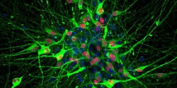 First Serotonin Neurons Made From Human Stem Cells