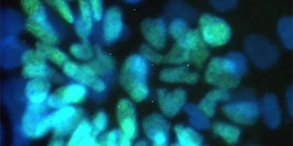 Embryonic Stem Cells And Artificial Stem Cells - What's The Difference?