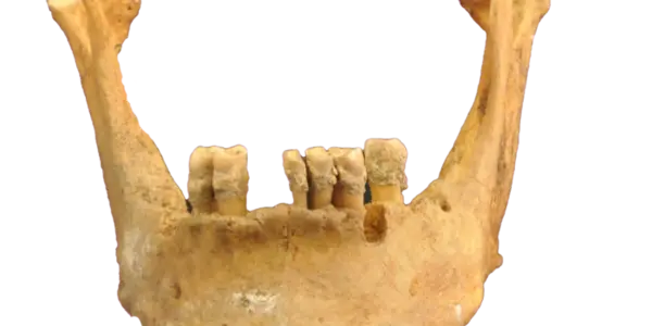 Featured Image