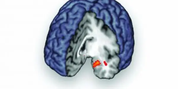 Brain Releases Opiod Painkillers During Social Rejection Too