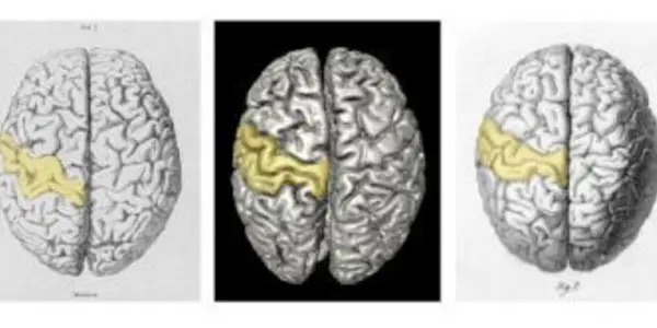 That's Not The Brain Of Carl Friedrich Gauss