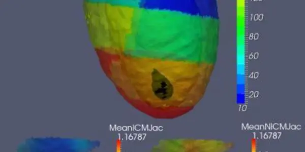 Diffeomorphometry And Geodesic Positioning Systems For Human Anatomy