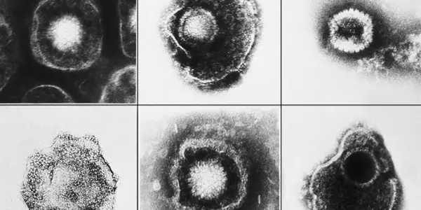 The Benefits of Our 100 Million-Year Relationship With Herpesviruses