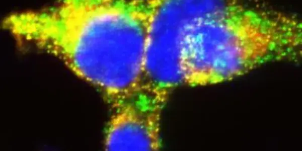 Insulin Pathway Map Could Lead To Better Diabetes Drugs