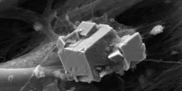 'Artificial Bones' Generated From Adult Stem Cells In Umbilical Cord Blood Gets A Patent