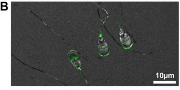 Genetic Testing To Produce More Fleckvieh Cattle - And Maybe Help With Human Infertility