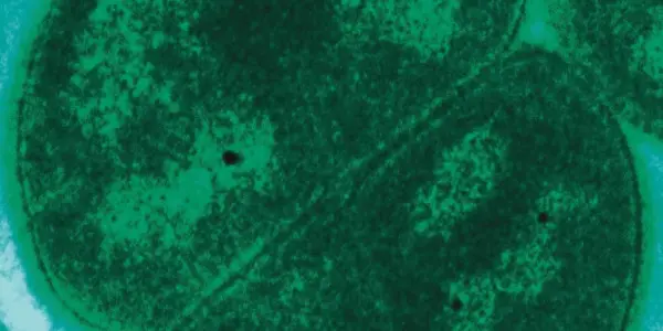 Could Microbes Transferred On Spacecraft Harm Mars Or Earth - Zubrin's Argument Revisited
