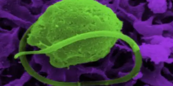 CSI Evolution: Genes Stolen, Bigelowiella Natans Algae Implicated