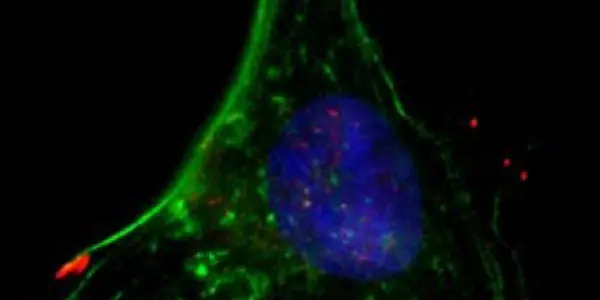 How Cancer Cells Groove: Rock And Rho Proteins
