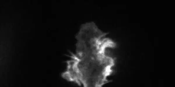 P53 Cuts Off Invading Cancer Cells