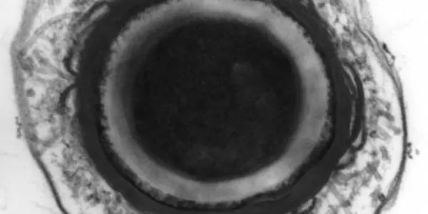 Neurotoxin: Mining The Clostridium Botulinum Genome
