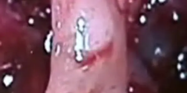 Foot grows in baby's brain - includes the photo, be warned