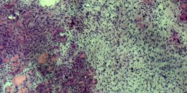 Adult Stem Cells Reverse Muscle Atrophy In Elderly Mice