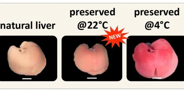 Perfusion System Could Revolutionize The Organ Donation Time Window