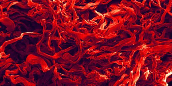 Why Does Human Skin Have Such Remarkable Toughness?