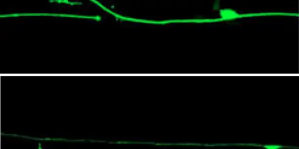 Genes Discovered That Repair Neurons