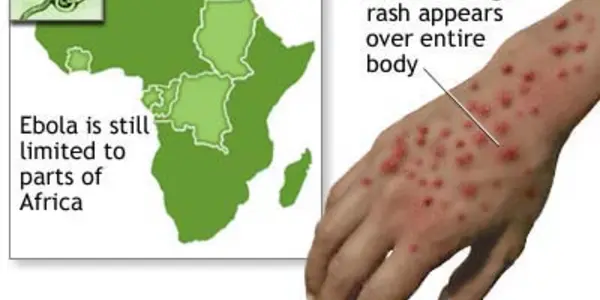 EBOLA