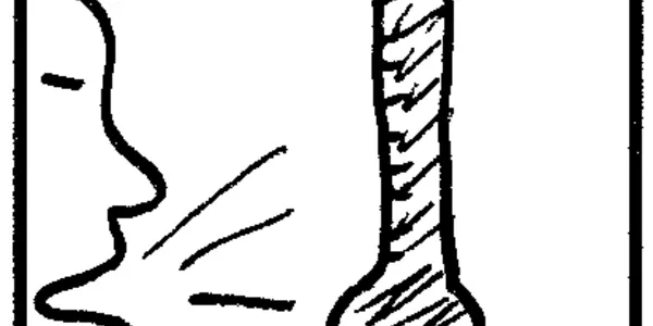 Yawns, Brain Sweat, And Boiled Parakeets
