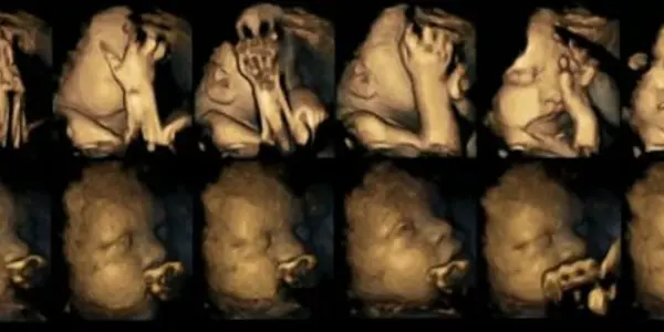 Facial Movements Of Unborn Babies Show Effects Of Maternal Smoking?