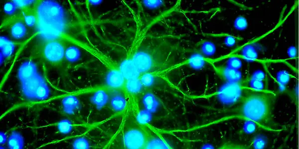 Brain Crash, Brain Reboot, Jill Bolte Taylor and Self Transcendence