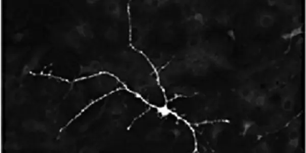 Aged Neural Stems Cells Still in Running Order