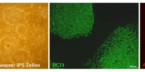 Stem Cells From Amniotic Fluid