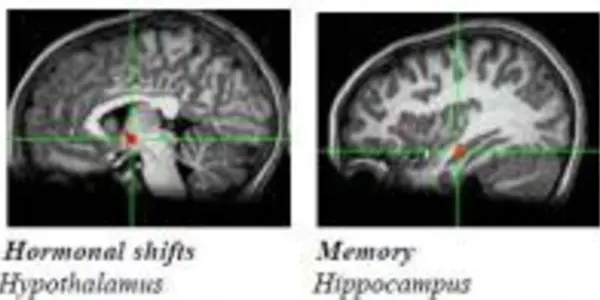Oh No You Didn't - Teen Girls Emotion Circuits Spark More Than Boys