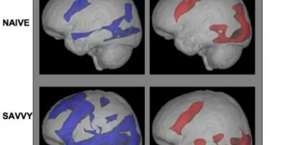 Learning 'Greases' Connections Between Brain Regions