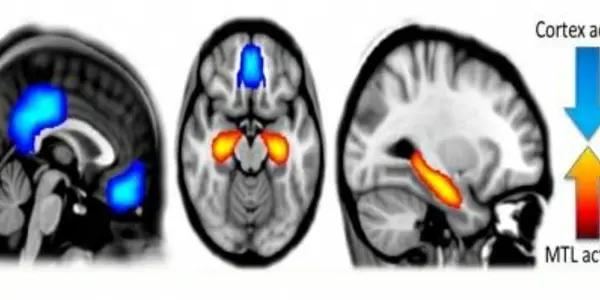 Dream State And Lower Sense Of Self - Psychedelic Drugs Get A Science Explanation