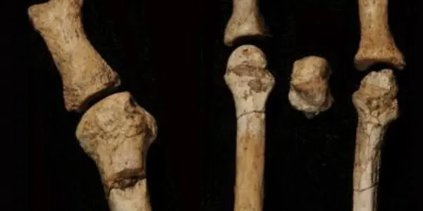Burtele Hominin - New Kid On The Evolution Block