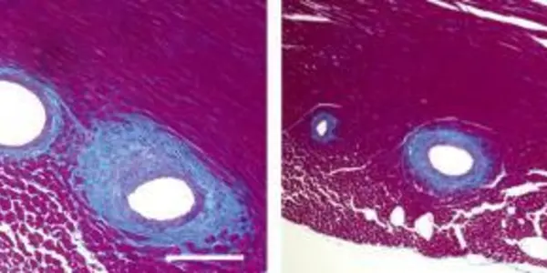 Utilizing Fat's Healing Properties In Heart Disease