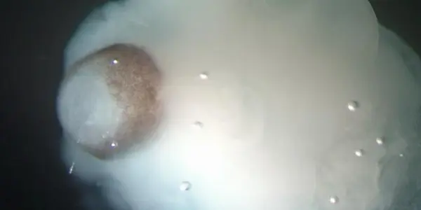 Organoids Get Cerebral