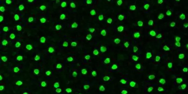 Cholinergic Amacrine: Heritable Nerve Cell Creates A 'Personal' Space