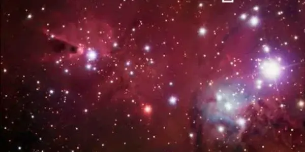 Untrasound For Baby Stars  - Determining Age By Sound Waves