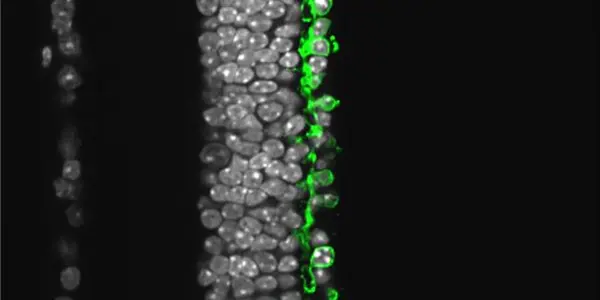 Halorhodopsin - Microbial Protein Restores Vision In Blind Animals