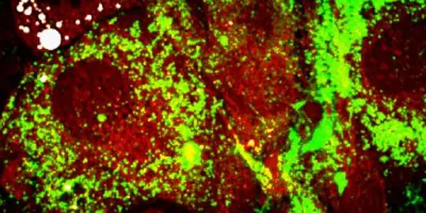 Adipogenesis - Insulin Processing, Not Genetics, Causes Obesity