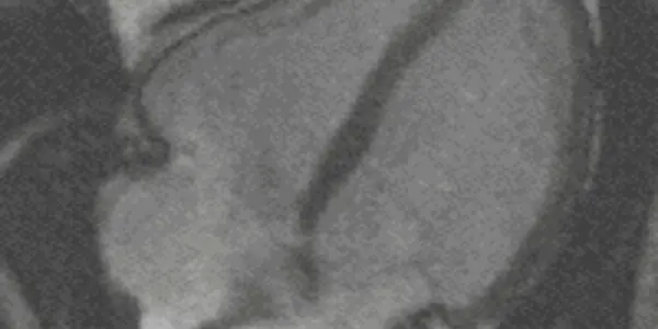 Discovered: Key Regulator Of Heart And Blood Vessel Development (And It Can Be Manipulated)