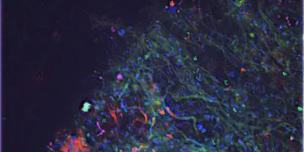Bacteria, Archaea And Microbial 'Ropes' Found In Underground Cave Lake