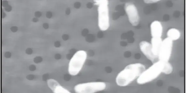 GFAJ-1: Has This Microbe Redefined The Definition Of Life?