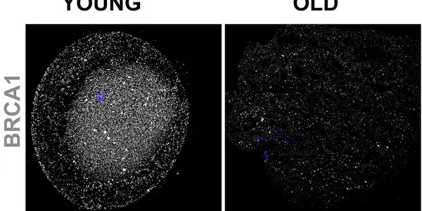 The Molecular Reason Female Fertility Declines With Age?