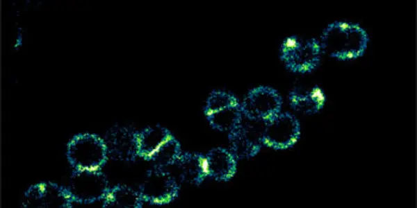 Antibiotic Resistance Threatens A Return To "The Dark Ages Of Medicine"
