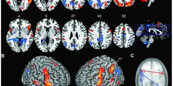 To Jazz Musician Brains, Music And Language Are A Lot Alike - But When They Play, Something Different Happens...